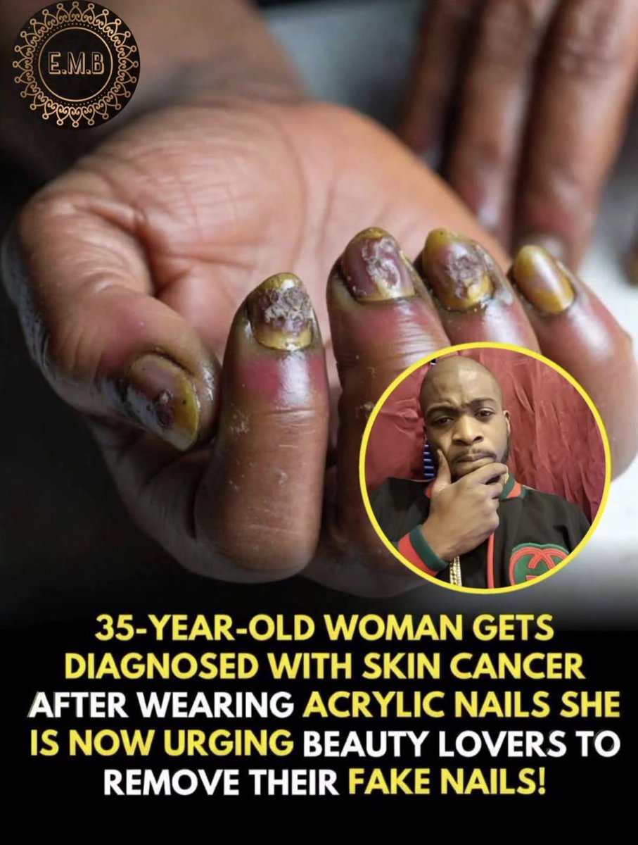 Typical African tweet media