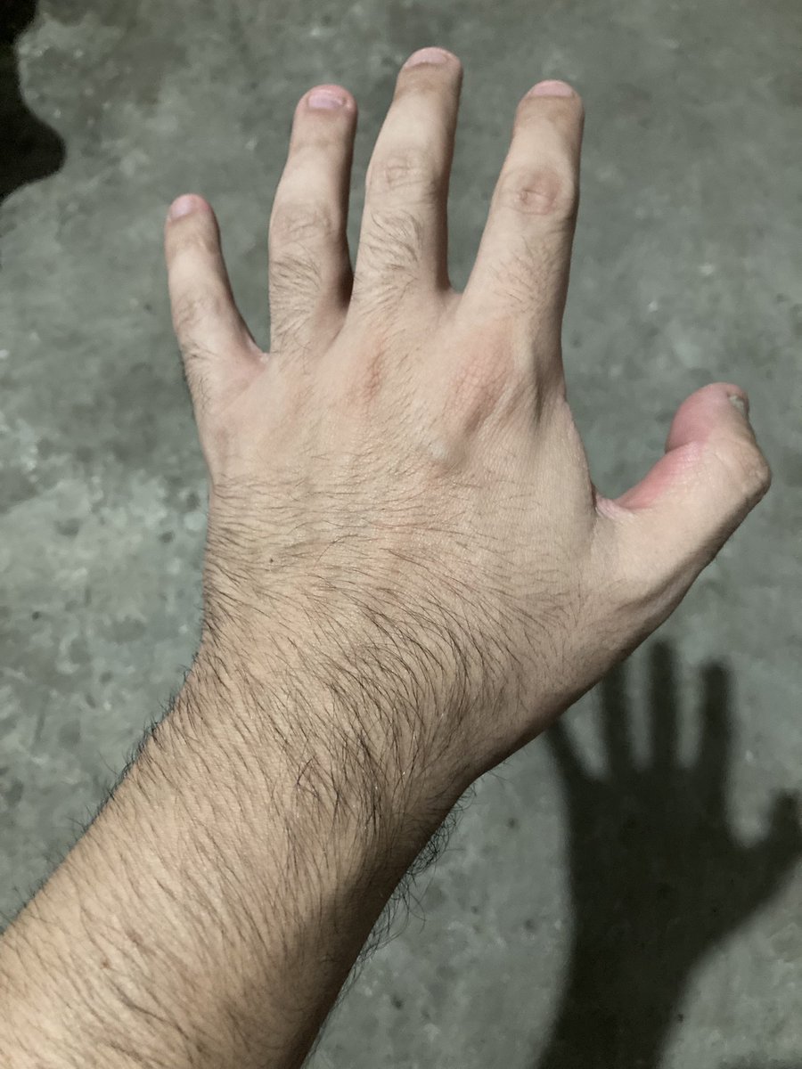 How hairy are you, guys?