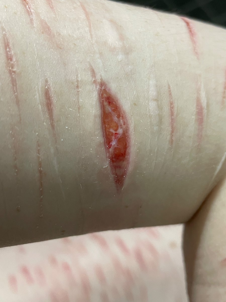 marz of shedtwt ALT tweet media