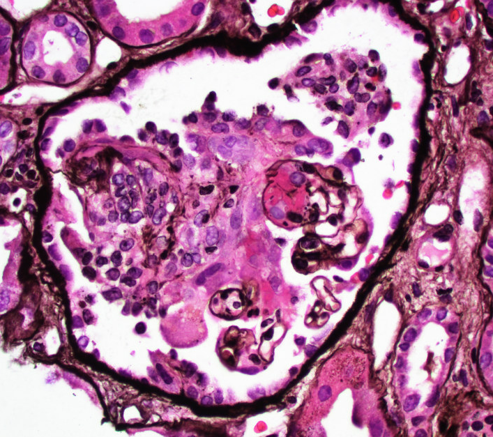 Jonathan Zuckerman MD PhD tweet media