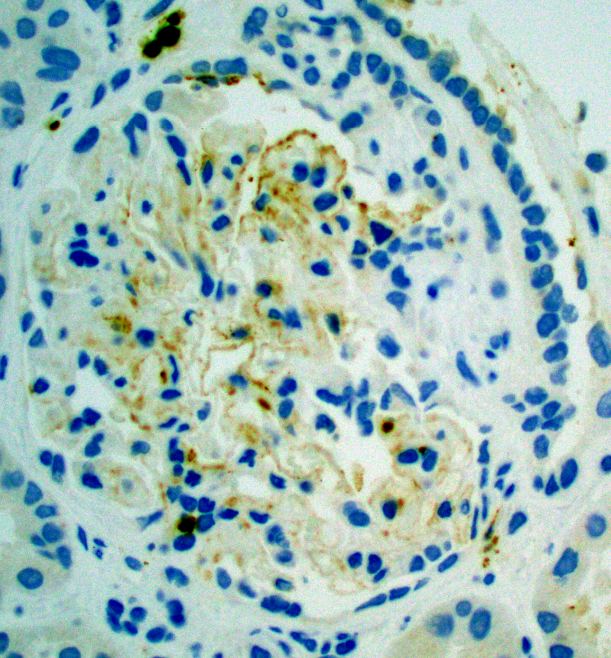 Jonathan Zuckerman MD PhD tweet media