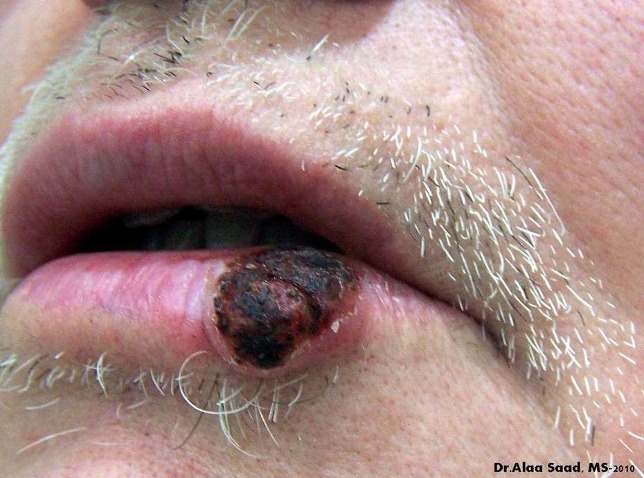 dermRounds tweet media