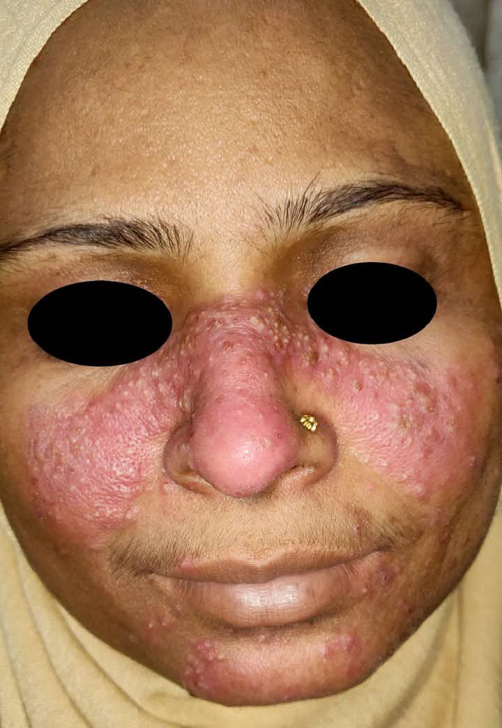 Dr.Haitham Hamoud | د.هيثم tweet media