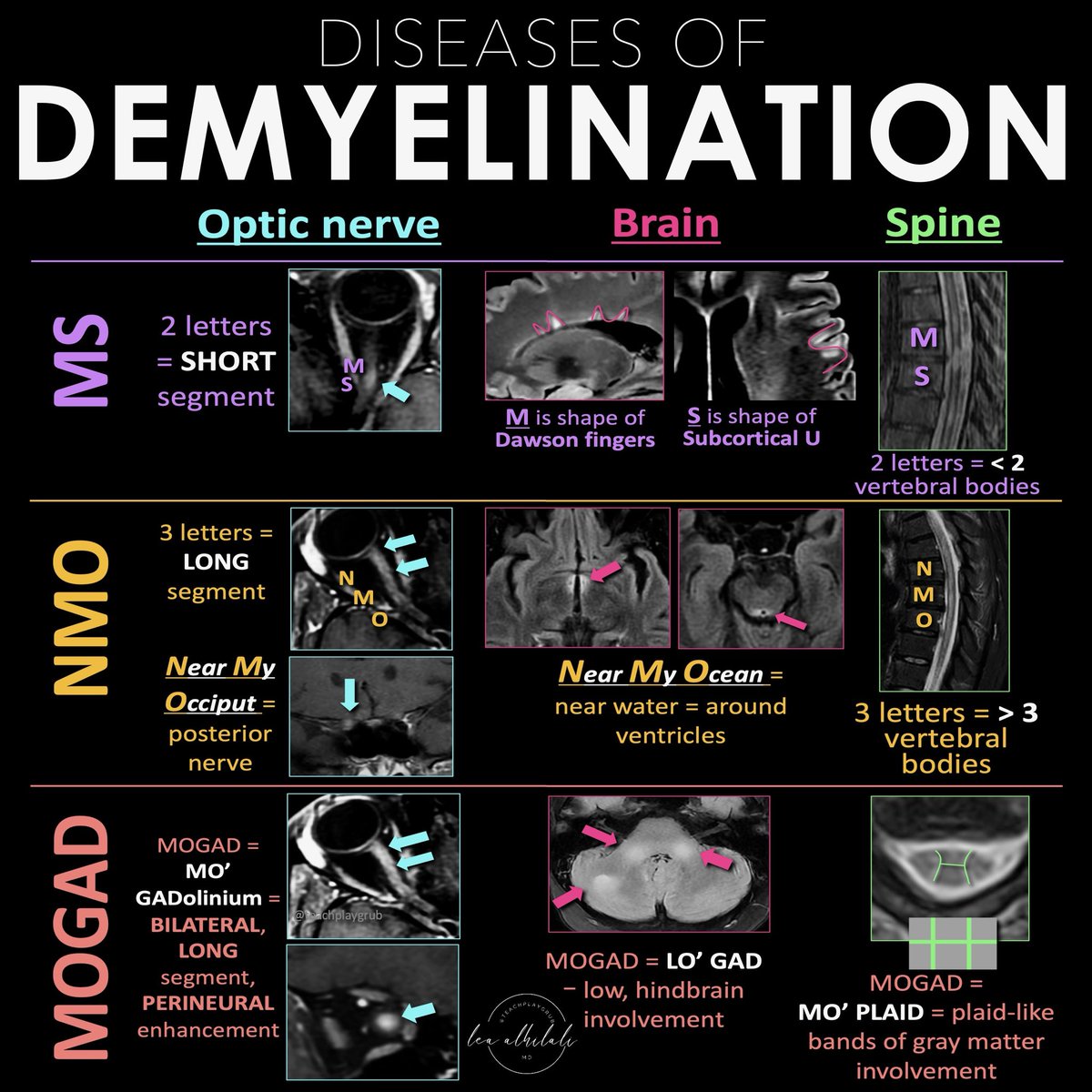 Lea Alhilali, MD tweet media