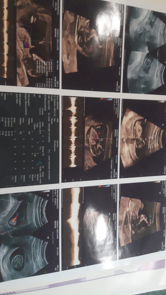 Nishu0528 tweet media