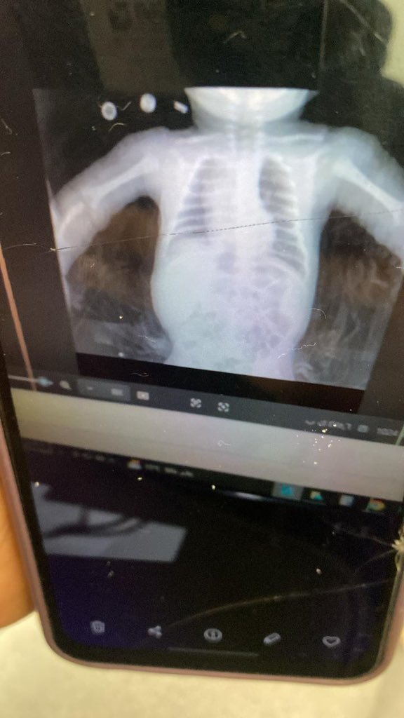 YounisNahil tweet media