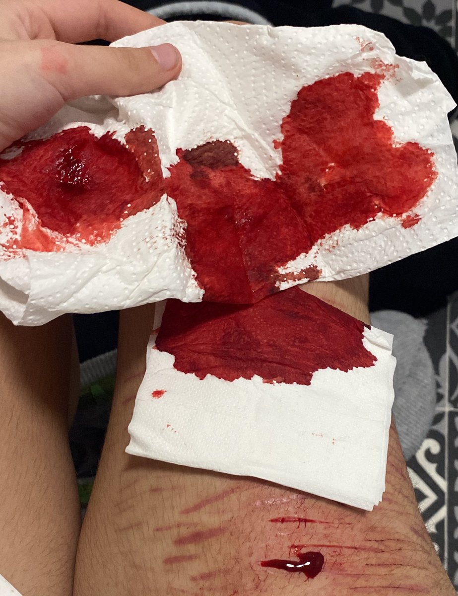 frerardie of shtwt 🦇 tweet media