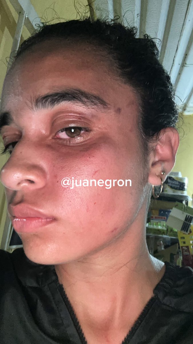 Juan Pablo González 🇻🇪 tweet media