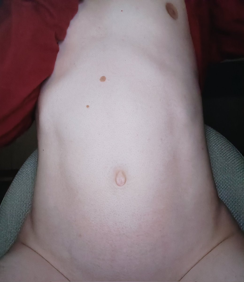 Max 🍉 tweet media