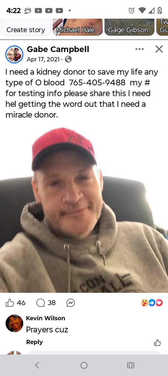 AmyYChester's tweet image. Any kidney donors?  @HHSGov @SecKennedy @DrOzCMS #kidney #donors #Oblood @nkf