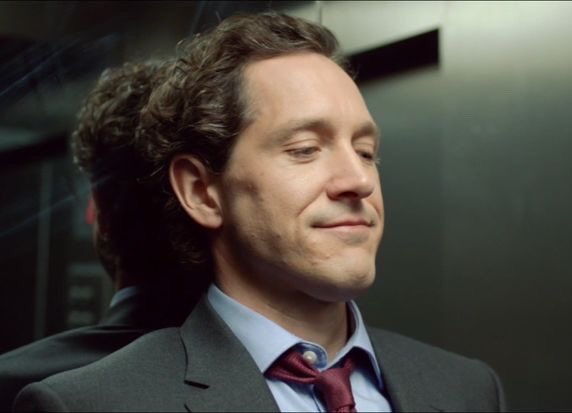 severe case of a cat face syndrome