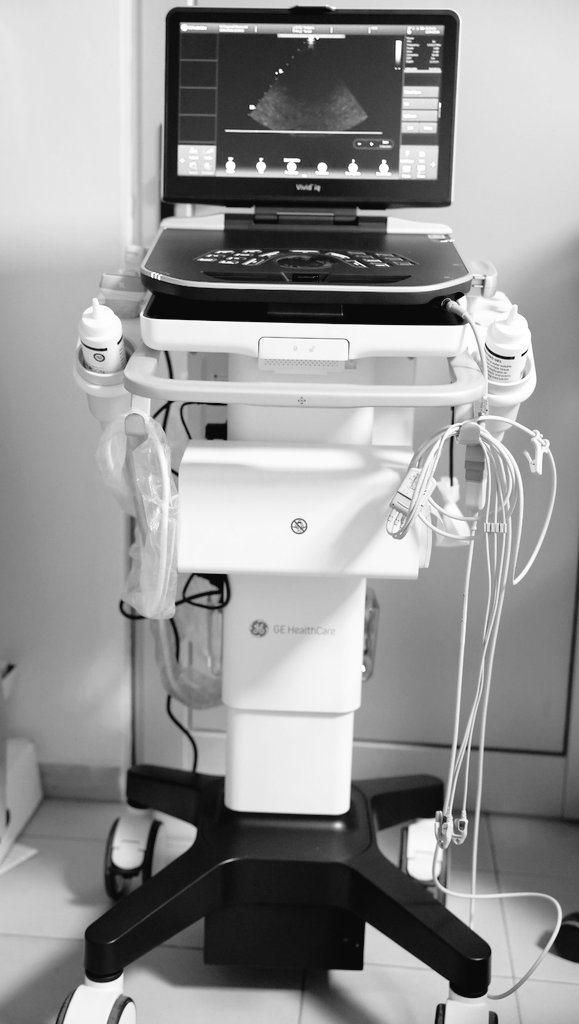#CHUK Cardiology Unit acquires high-end GE Vivid IQ Premium Echocardiography Machine equipped with AI to offer high accuracy,precise&amp;quality diagnosis.The cutting-edge tech eqpt is already anabling our Cardiologist to perform advanced Echocardiography tests not done at CHUK..1/2