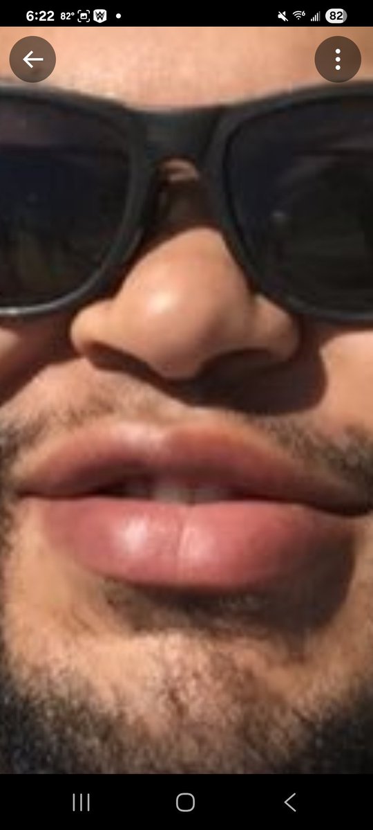 Rob Allen tweet media