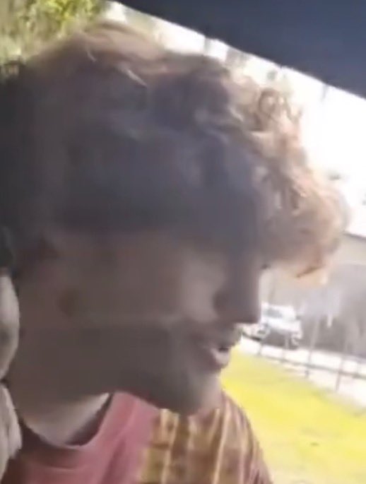 thought this was a hickey lwk (bad pause)