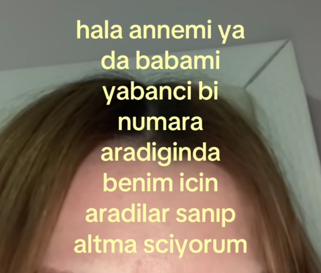 susu⁷ 💫 tweet media