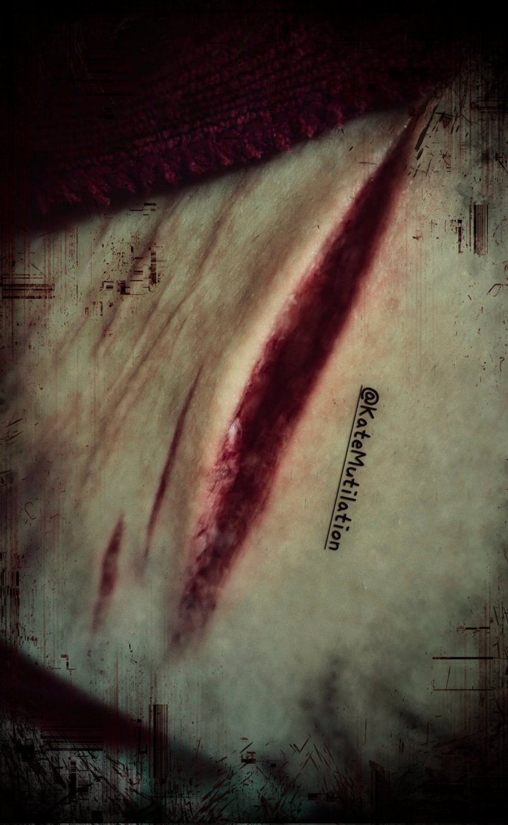 KateMutilation's tweet photo. #shtwt https://t.co/rp9tNV6lKT