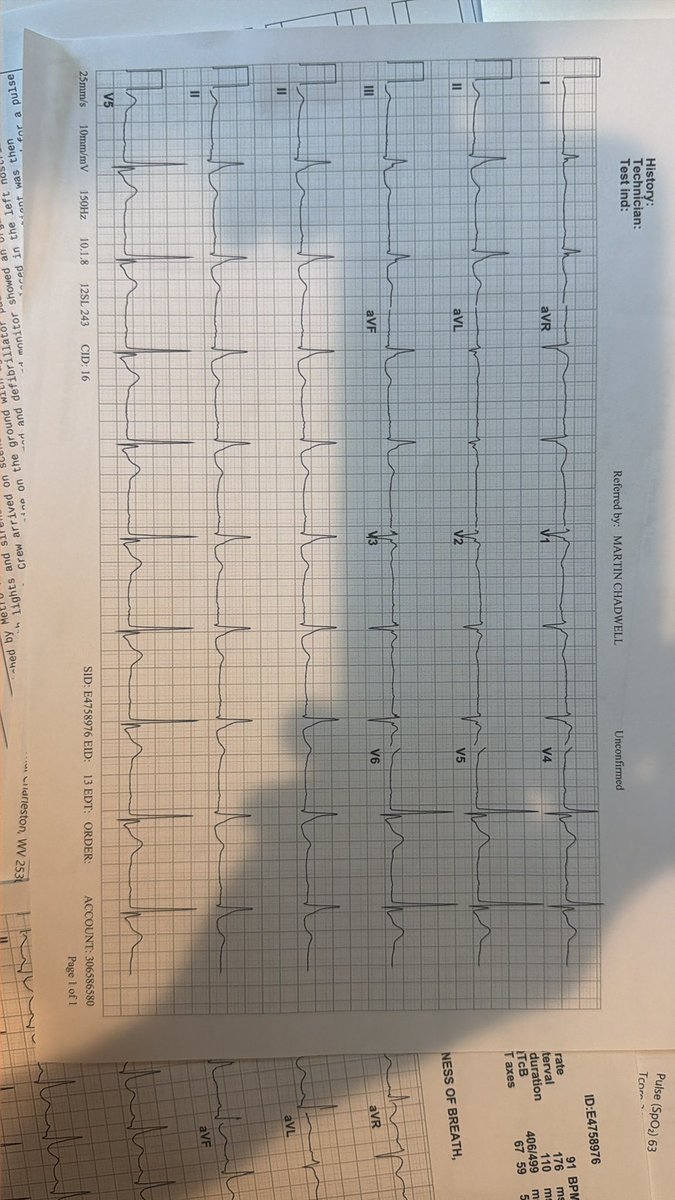 EPDocWase's tweet photo. A 47-year-old African American male out of hospital cardiac arrest with bystander, CPR and defibrillation. K was 2.7. 
ER syndrome versus Torsade? https://t.co/PzM7zxMz9A