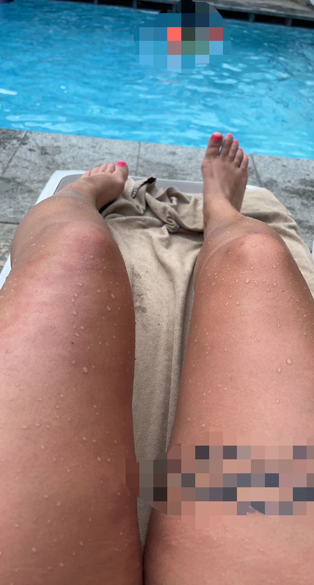 Tiffanyozfz's tweet image. #onlyfans
#newbie

onlyfans.com/dreamytoes55