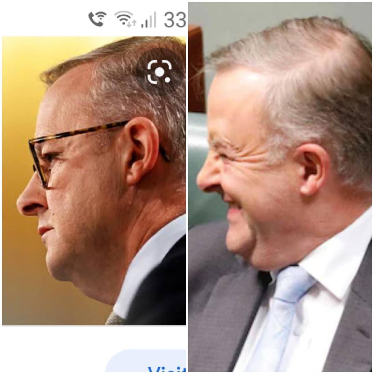 Lynn Phillips tweet media