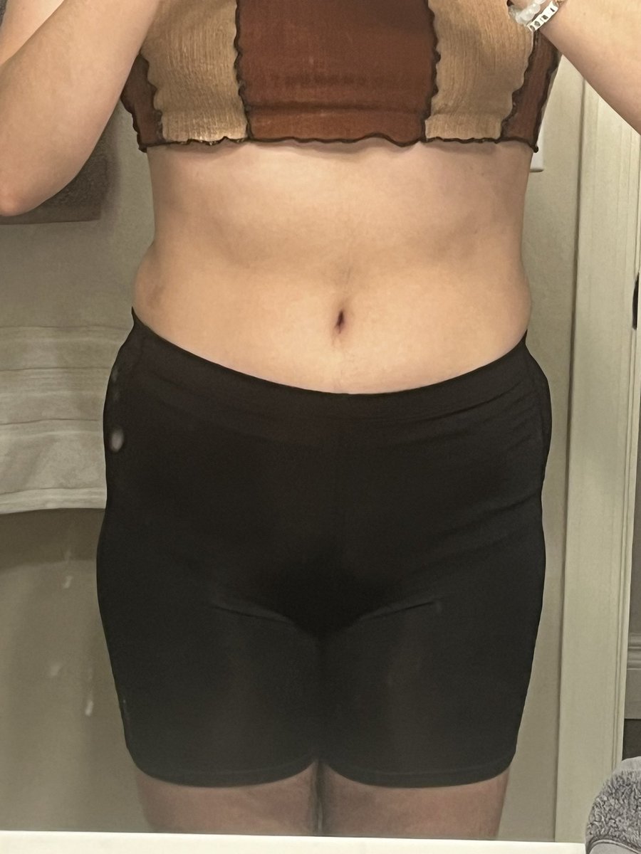 kamcvts's tweet photo. tw bc
only time i can even *tolerate* how my stomach looks is in the first 2 pics cuz im standing w ballet posture 
when i stand normally i look so fucking WIDE!! #edtwt https://t.co/yO82m0BhPC