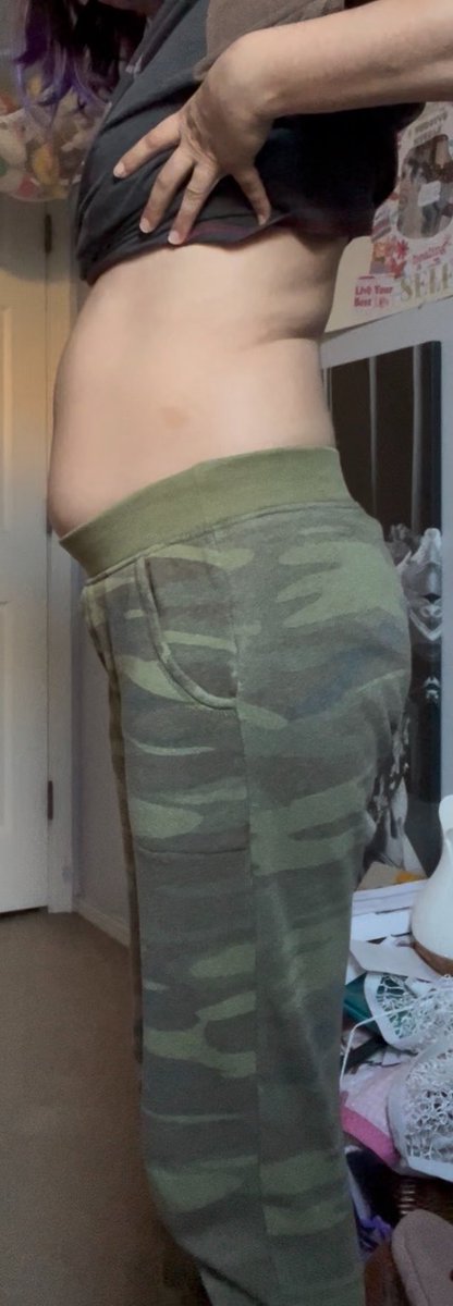 kamcvts's tweet photo. tw bc
only time i can even *tolerate* how my stomach looks is in the first 2 pics cuz im standing w ballet posture 
when i stand normally i look so fucking WIDE!! #edtwt https://t.co/yO82m0BhPC