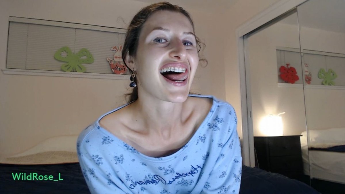 VID SOLD! Pop for Me while I pop-in my Retainers 🔥 Check it out! manyvids.com/Video/7416991/… #MVSales @manyvids