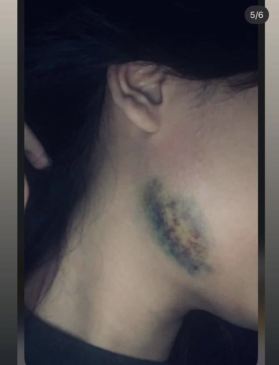 omicabul tweet media