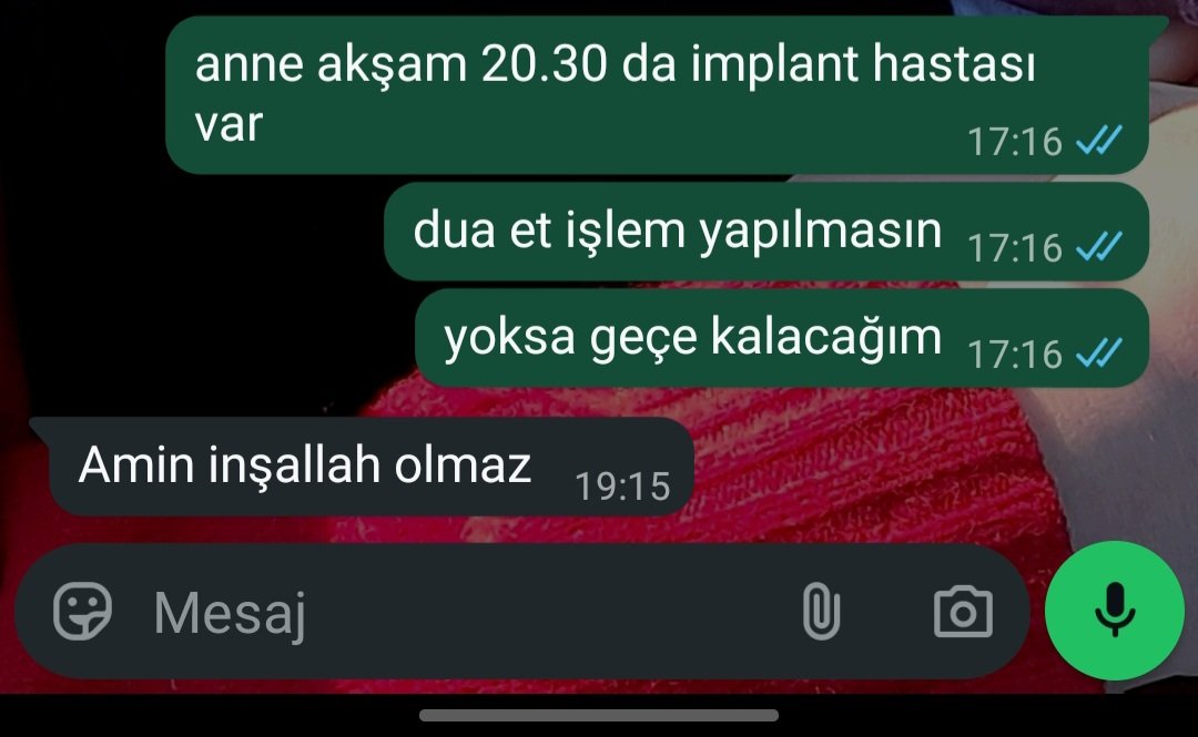 bskdhdkxjsljd anne harikasın ama yapıldı maalesef