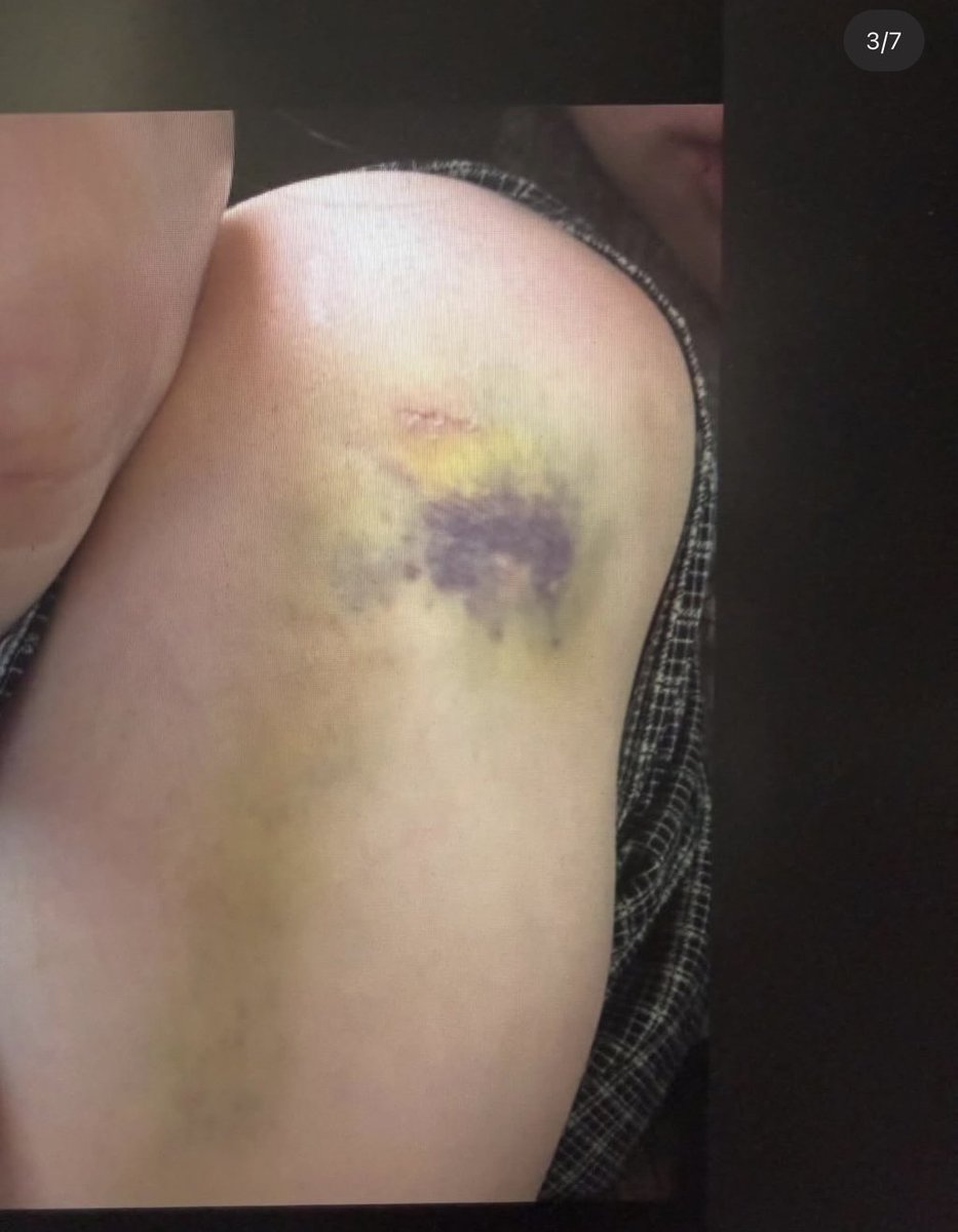 Aespann_jeans tweet media