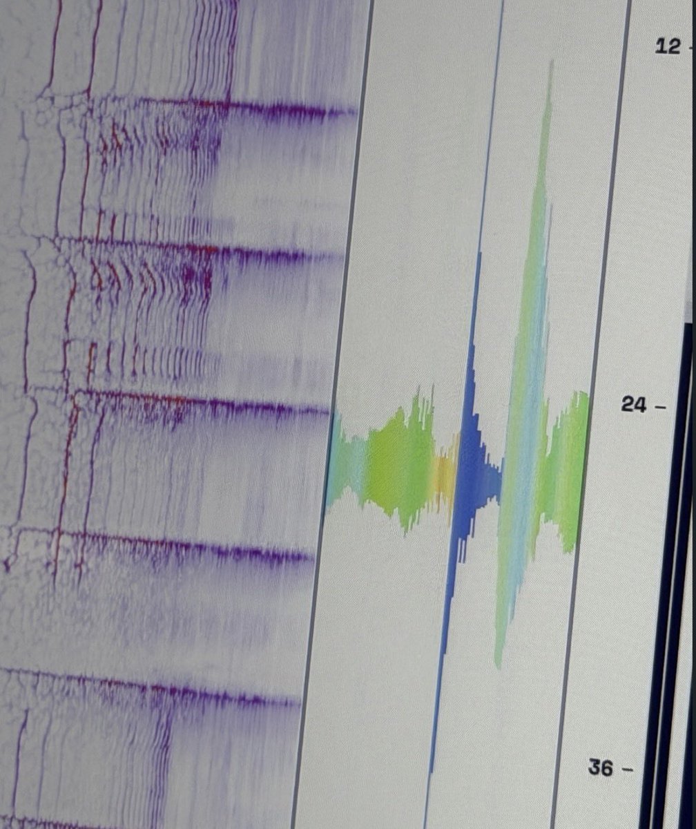 EVAN BASE tweet media