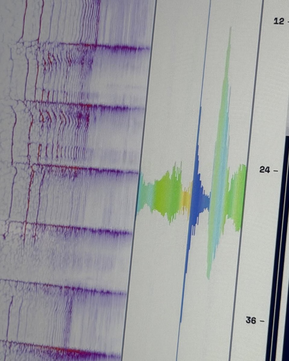 LEE HEESEUNG GLOBAL tweet media