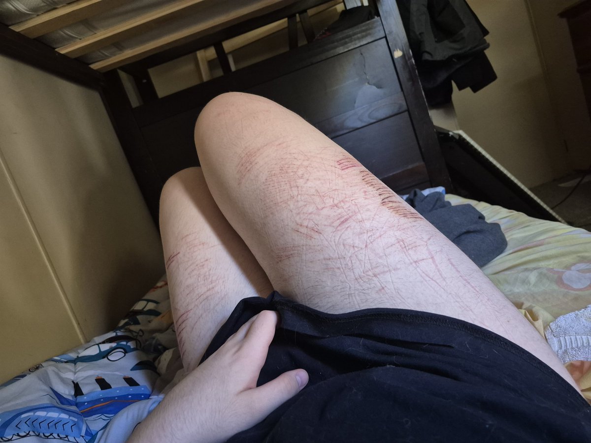 kiwikebob's tweet photo. another thigh pic https://t.co/UxgzmCYclz
