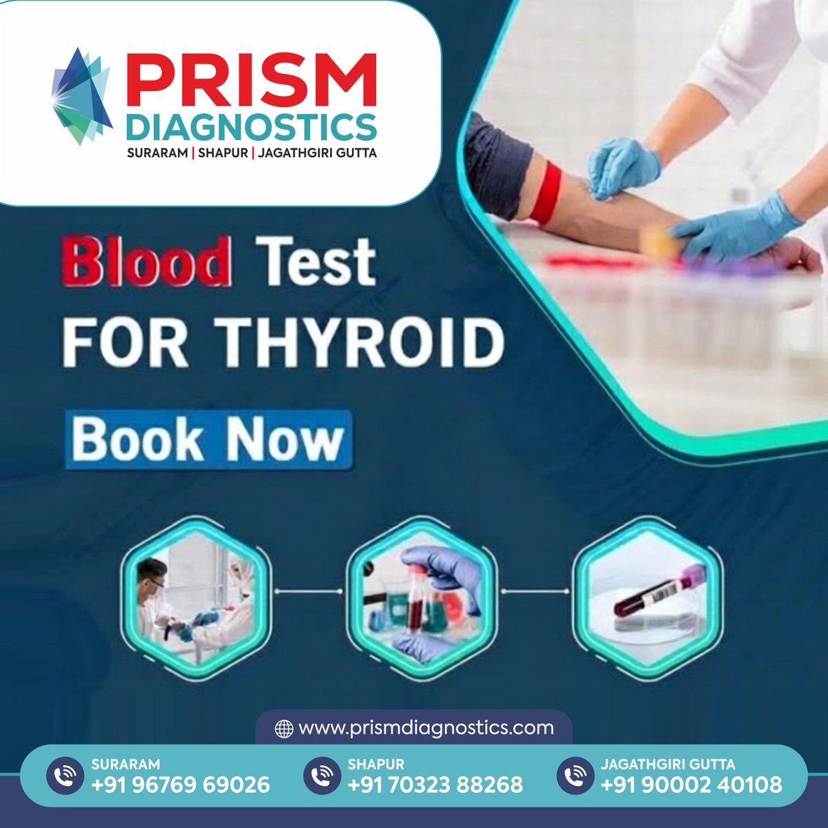 PrismDiagnostic's tweet image. Blood Test FOR THYROID

Book Now

🔘 Prism Diagnostics 🔘
📞 Suraram: +91 96769 69026
📞 Shapur: +91 70323 88268
📞 Jagathgiri Gutta: +91 90002 40108
✉️ prismdiagnosticsinfo@gmail.com
🌐 prismdiagnostics.com

#ThyroidTest #ThyroidCheck #ThyroidHealth #TSHTest #T3T4Test