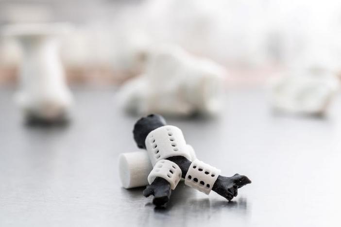 Moath_Abuaysha's tweet image. 🫁 دعامة #3D 
تُنقذ أنفاس الأطفال

⚠️ المشكلة
تليّن القصبات يسبب انهيار مجرى التنفس لدى الرضع

🩻 الحالة
تجارب جامعة ميشيغان تعالج حالات tracheobronchomalacia فشلت معها الحلول التقليدية

✅ الحل
دعامة مطبوعة ثلاثيًا قابلة للتحلل
  
👨‍⚕️ الأطباء
Richard Ohye
Glenn Green

⚙️ التقنية: