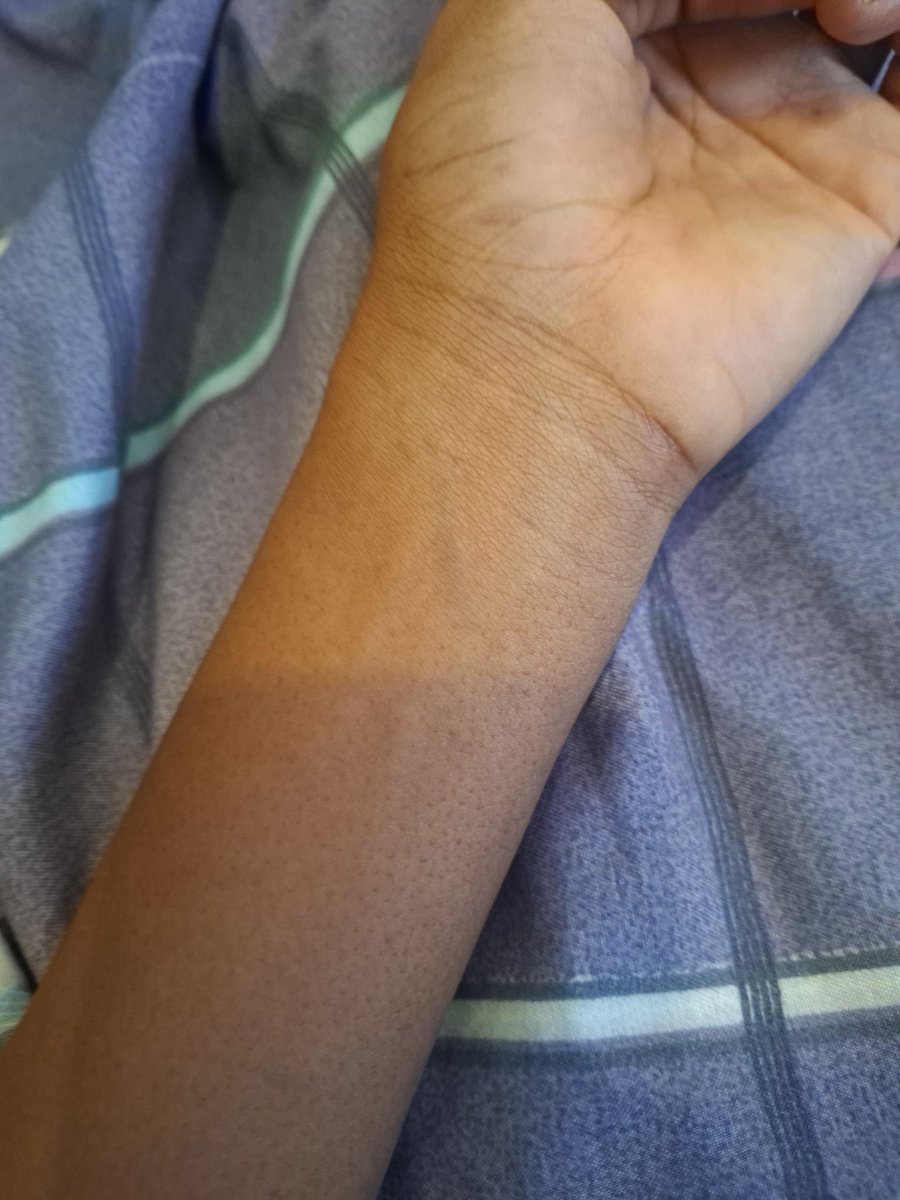 Sewn__shut's tweet image. Wrist bc ##bodycheck #edtwt #3d #kpop #wonyoungism