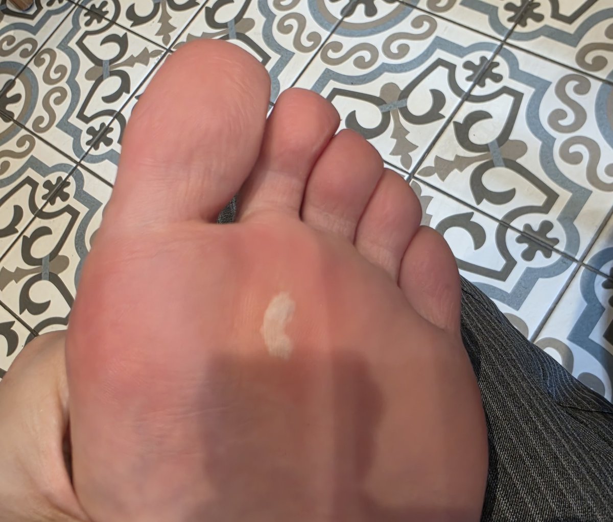 캠퍼 30만원짜리 신발 불호후기

사진대로 선물받았고 기분좋게 신음
바로 발에 물집잡힘
새신인가싶어서 2번더신음
또 물집
살때 본인브랜드 신발편하다고 불편하면 언제든 오라고함

갔음

방법이없다고(?) 얇은 깔창깔아줌
그리고 그냥 이 신발을 신고 오래걷지말래

나 2시간신음
못걸어지금