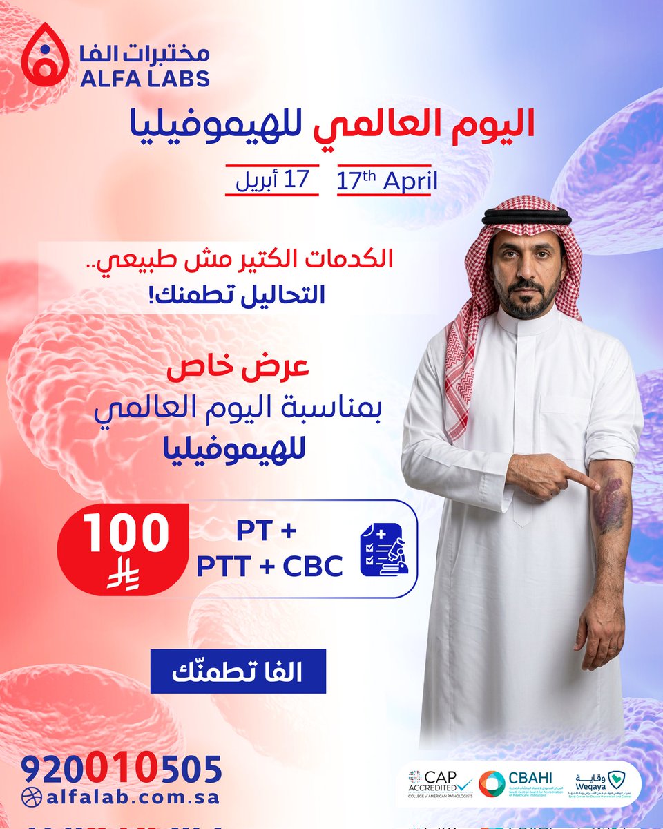 🩸 اليوم العالمي للهيموفيليا
الكدمات الكثيرة مو طبيعي
والتحليل يطمنك ✋
PT + PTT + CBC
100 ريال فقط
🏠 سحب منزلي مجاني
📲 احجز: alfalab.com.sa