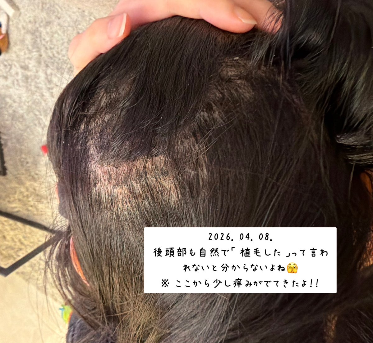 0c__73's tweet photo. 1週間〜2週間目突入のお写真です ૮₍  ᵒ̴̶̷ ᵕ ก̀ ྀི₎ა✨ https://t.co/ytlCeVg3kw