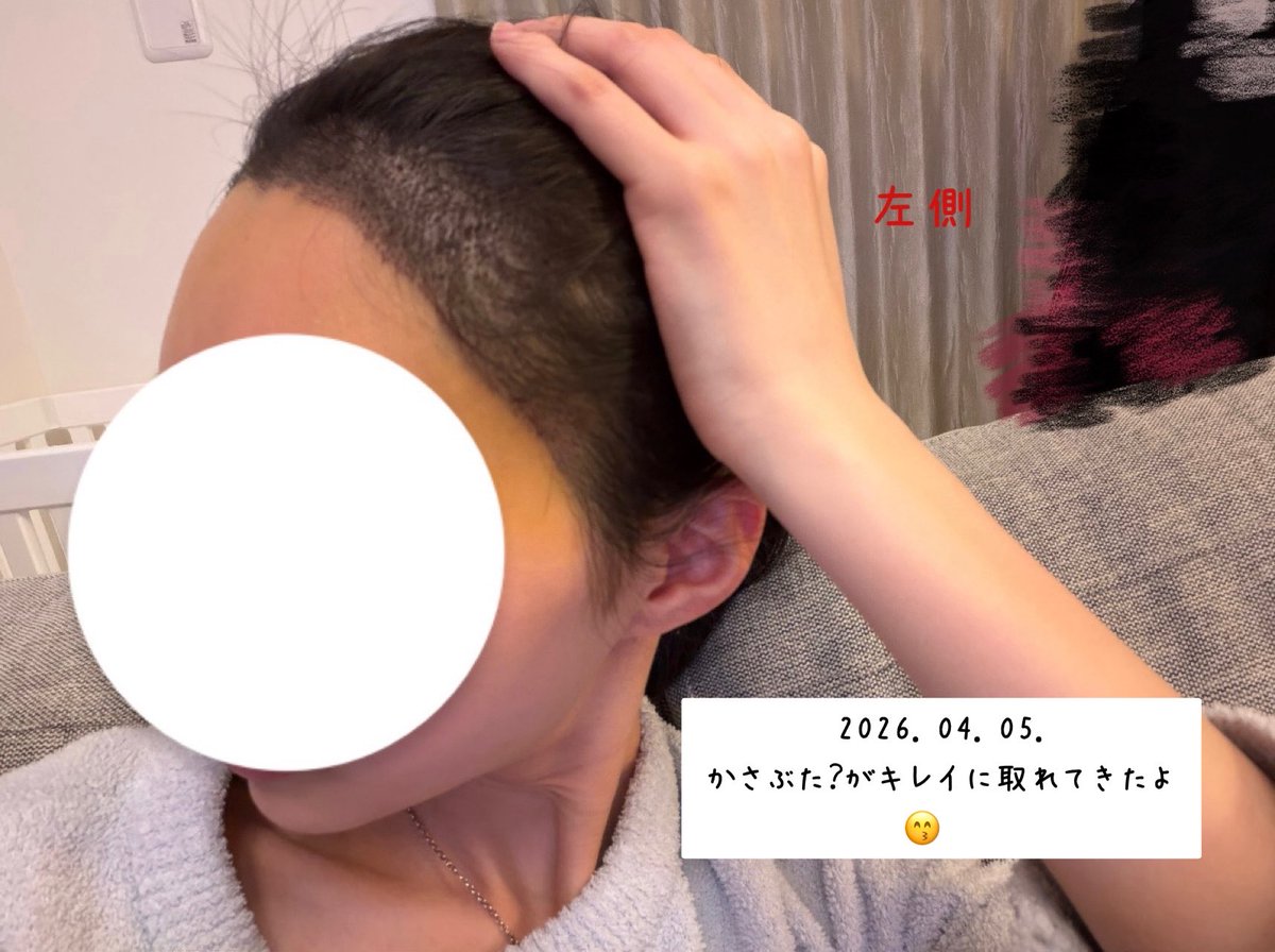 0c__73's tweet photo. 1週間〜2週間目突入のお写真です ૮₍  ᵒ̴̶̷ ᵕ ก̀ ྀི₎ა✨ https://t.co/ytlCeVg3kw