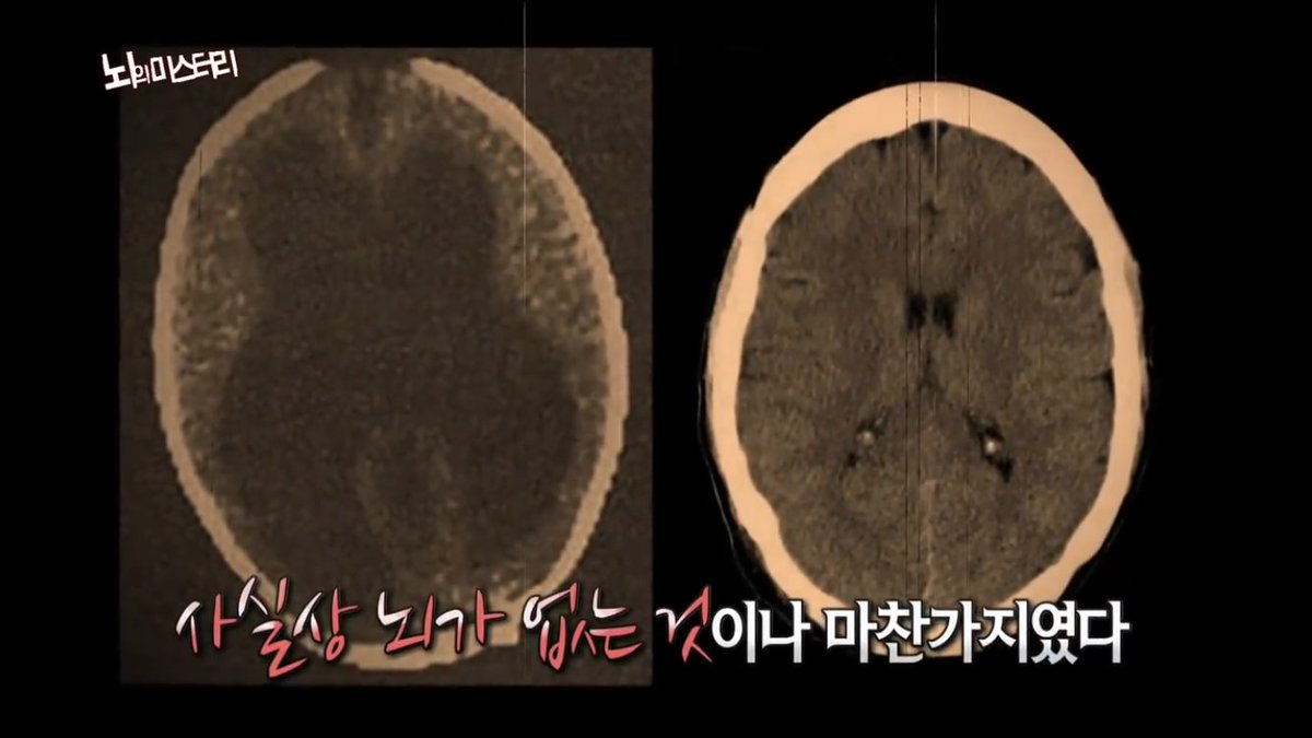 3시간 51분 21초동안 타이머를 키고 있었으면서 대체 왜 열품타를 킬 생각은 하지 않은걸까