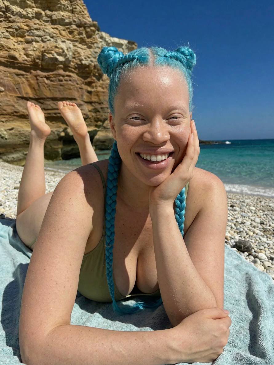 Luna Vale Diary | albino tweet media