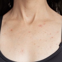 まるね｜垢抜け美容 tweet media