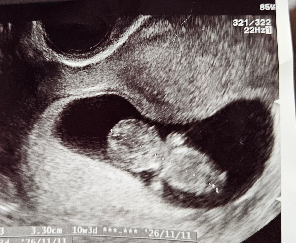 おさるママ＠子育て×健康料理ブロガー tweet media