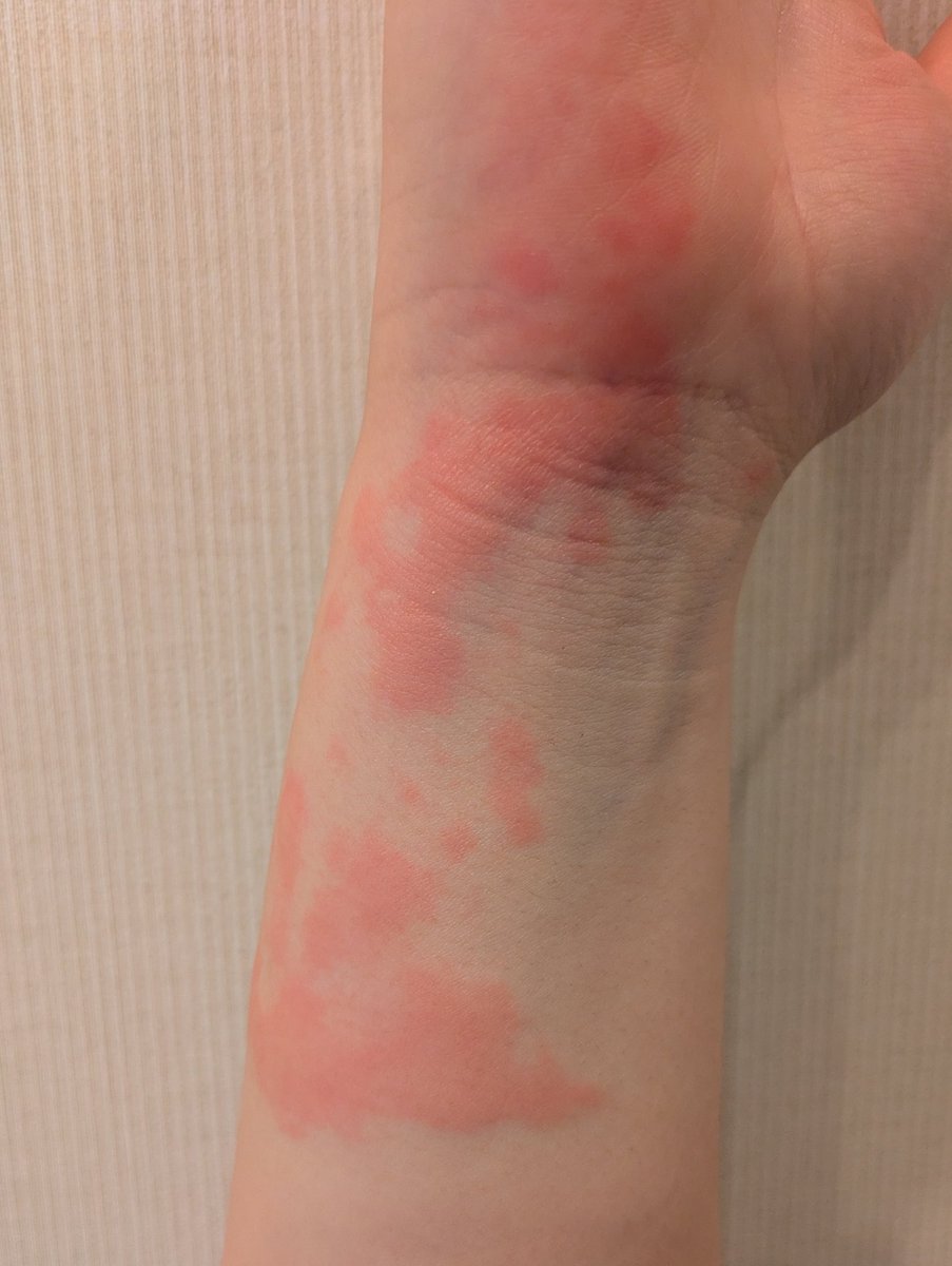 こけら tweet media