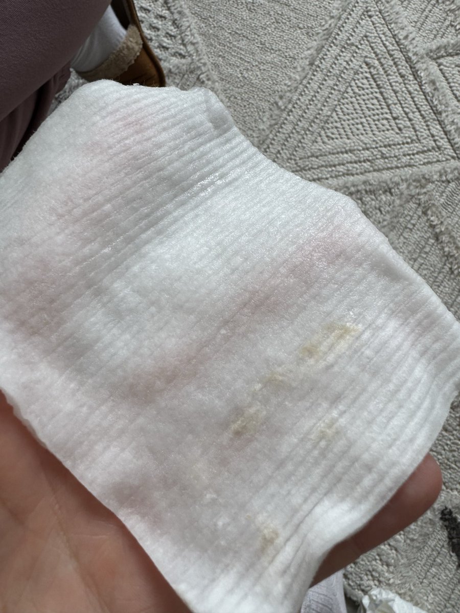 ebruusenn's tweet photo. @ebebek in baby me markalı güya hijyen pamuğunun içerisinde çıkan pamuklar. Bunu bebeğime nasıl kullanabilirim? https://t.co/fPKVn10bPu