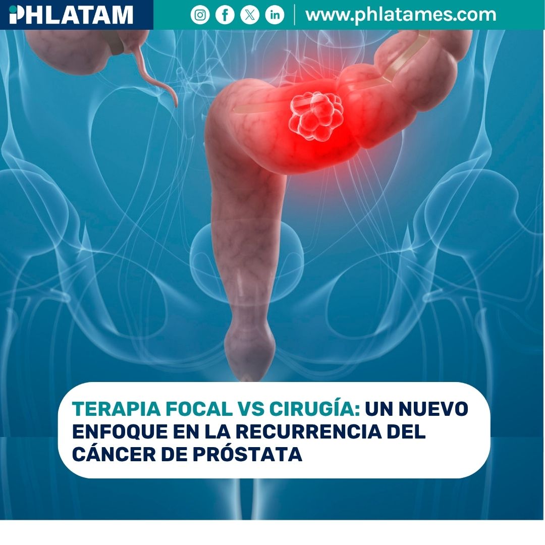 PH_Latam's tweet image. ¡Oncología! |  Un nuevo estudio sugiere que la terapia focal de rescate podría ofrecer resultados oncológicos similares a la cirugía, con un perfil de seguridad más favorable. 👉 Lee la nota completa: ow.ly/gvoc50YLrLN 

#PHL #CáncerDePróstata