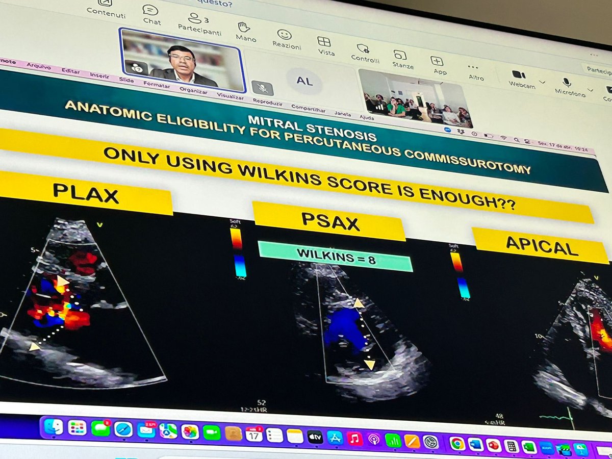 alexsfelixecho's tweet photo. ๐It was a great honor to participate as faculty in II Livelo Master of Echocardiography in Universita Cattolica del Sacro Cuore 2025/2026 invited by my friends Prof. Francesca Graziani @FGraziani_Grace , Prof. Antonella Lombardo @Anto_Lombard e Prof. Gabriella Locorotondo @GabriellaLocor1 ๐
A great opportunity to discuss the global burden of rheumatic heart disease, even in Europe and how #echofirst can be an essential tool from diagnosis to intervention, with advanced techniques as 3D echocardiography ๐
@Unicatt
@dicsbc @RosaLillo14 @meucci_chiara