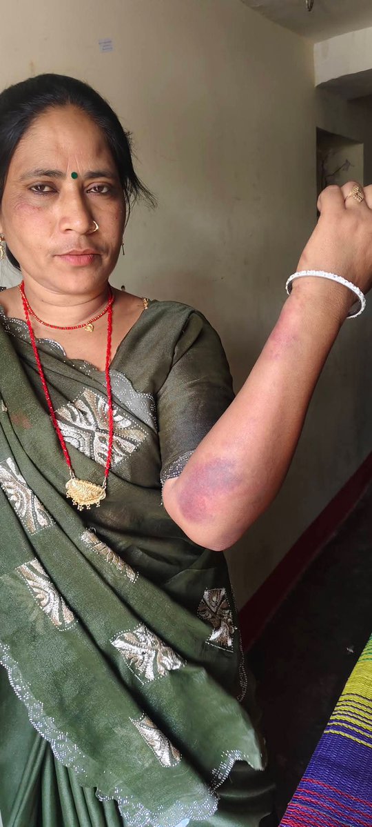 Sunil Astay tweet media