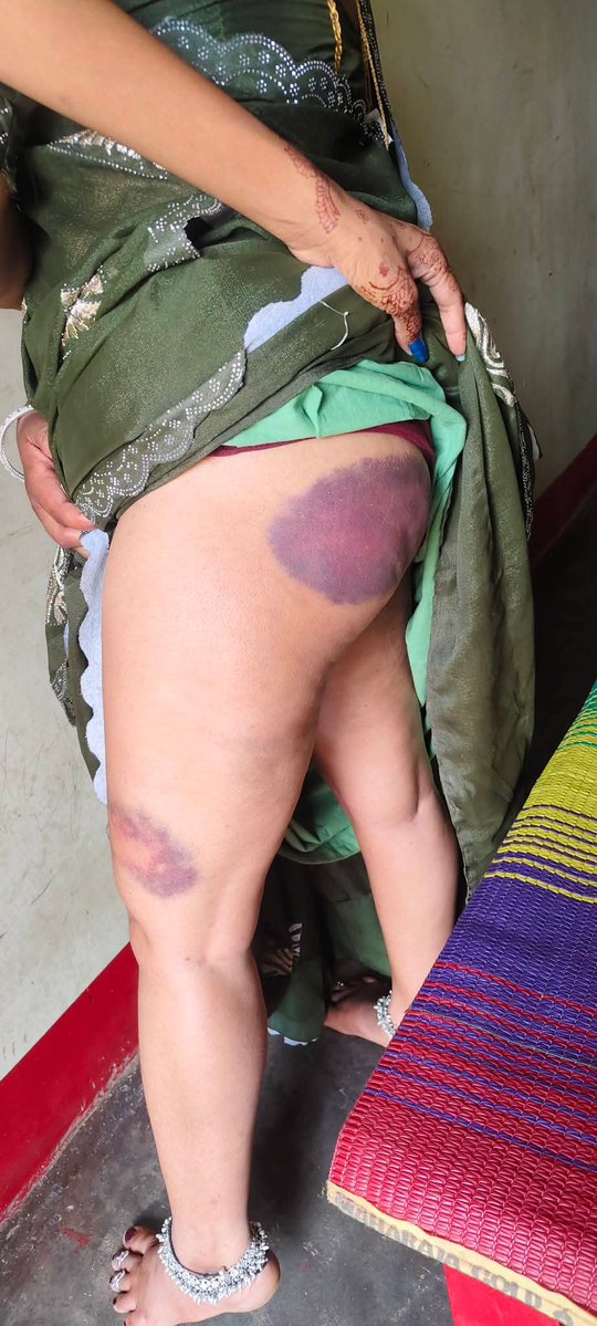 Sunil Astay tweet media