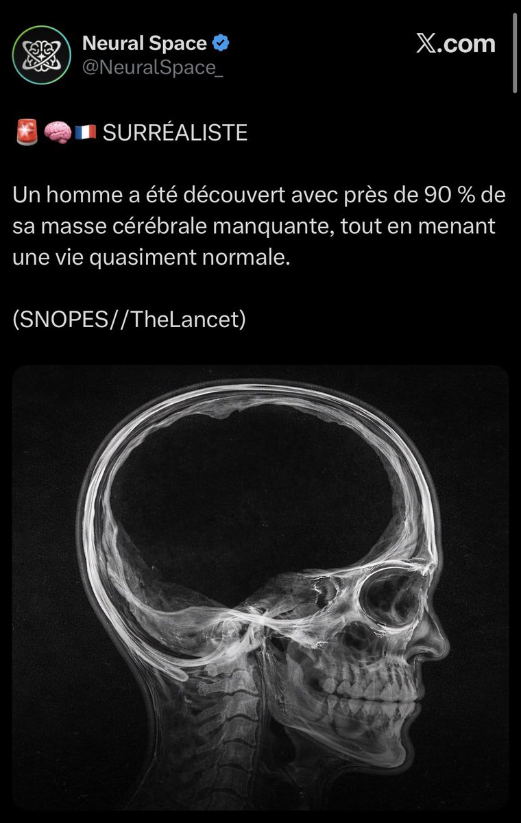 Non et prénon tweet media